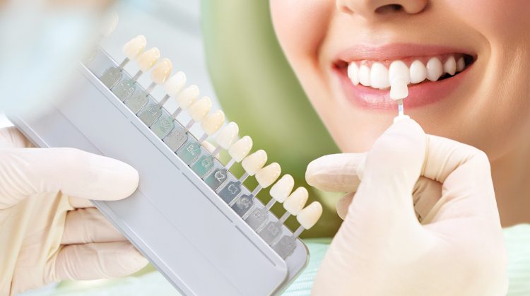 Close-up of a dentist matching a patient's tooth shade using a color guide for cosmetic dental treatment, showcasing a bright and healthy smile.